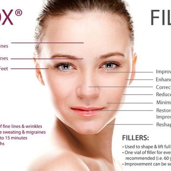 Facial Fillers