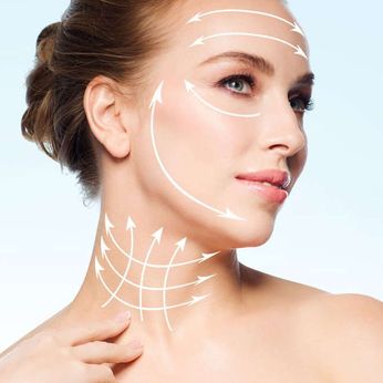 Facelift