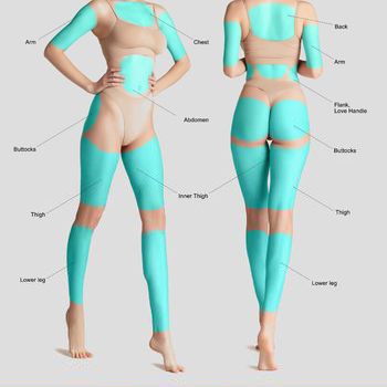 Liposuction