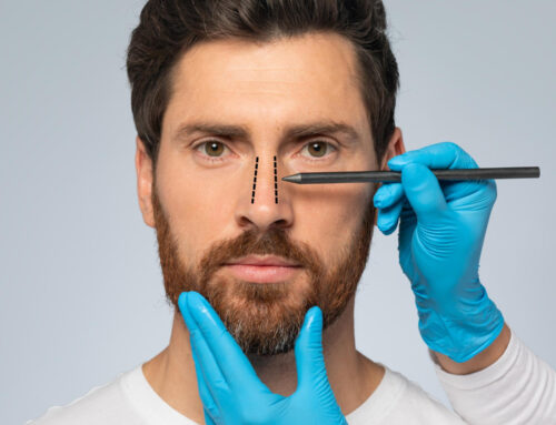 Understanding Blepharoplasty